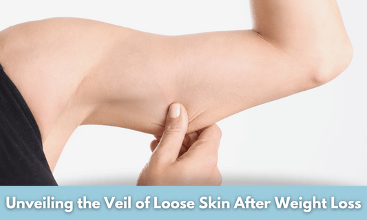 Loose Skin After Weight Loss