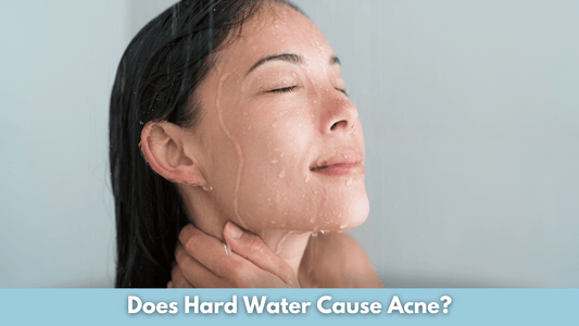 Does Hard Water Cause Acne?