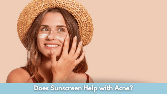 Does Sunscreen Help with Acne?