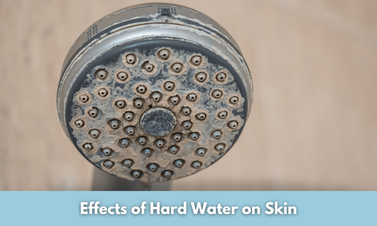 Effects of Hard Water on Skin