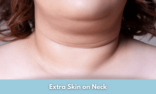 Extra Skin on Neck