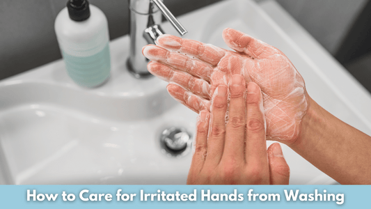 How to Care for Irritated Hands from Washing