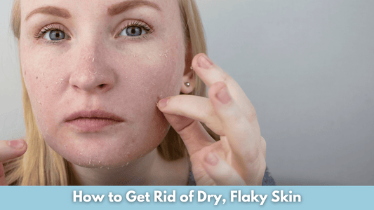 How to Get Rid of Dry, Flaky Skin
