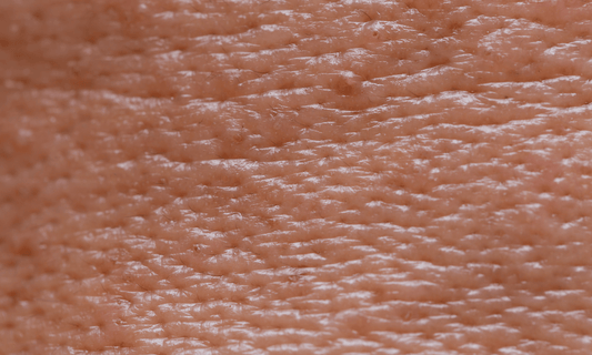 Oil Clogged Skin