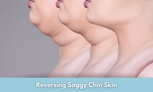 Reversing Saggy Chin Skin