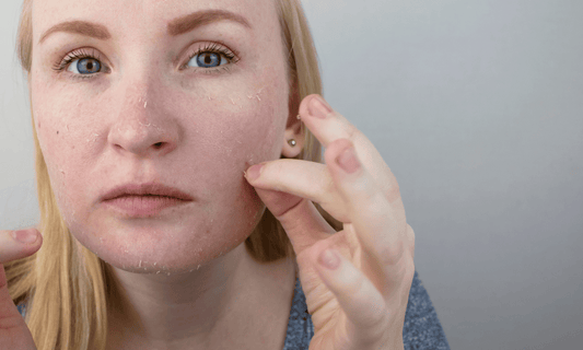 Scaly Skin on Womans Face