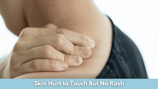 Skin Hurt to Touch But No Rash