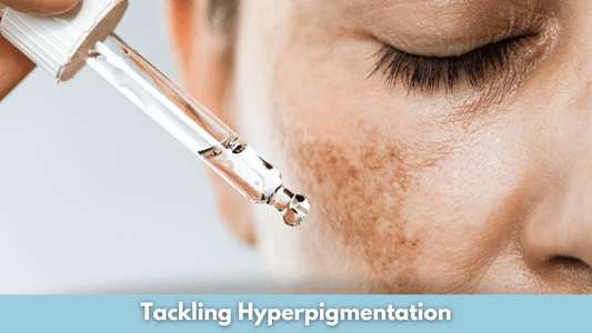 Tackling Hyperpigmentation