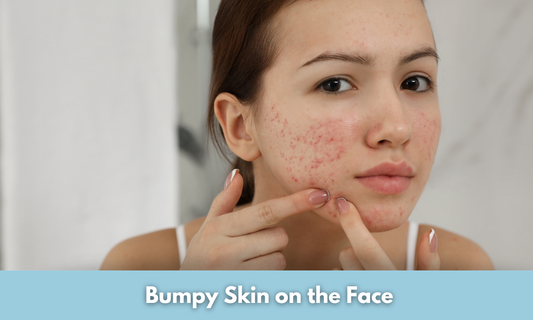  Bumpy Skin on the Face