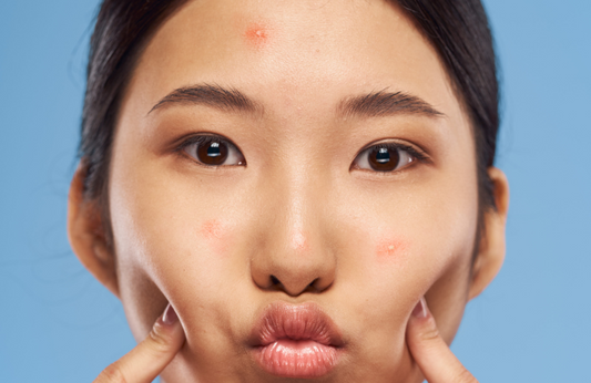 blue light therapy for acne guide