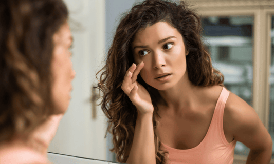 Dark Circles vs Eye Bags Blog