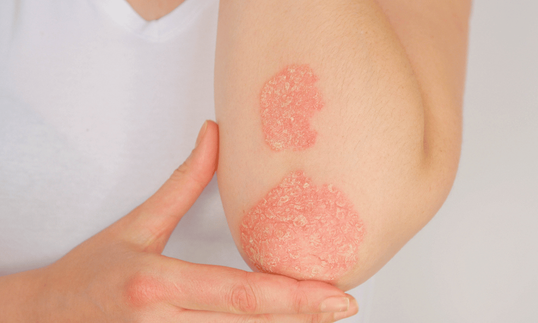 How Collagen can Improve Skin Health