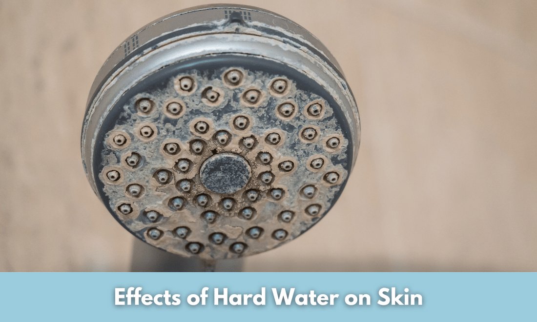 Effects of Hard Water on Skin