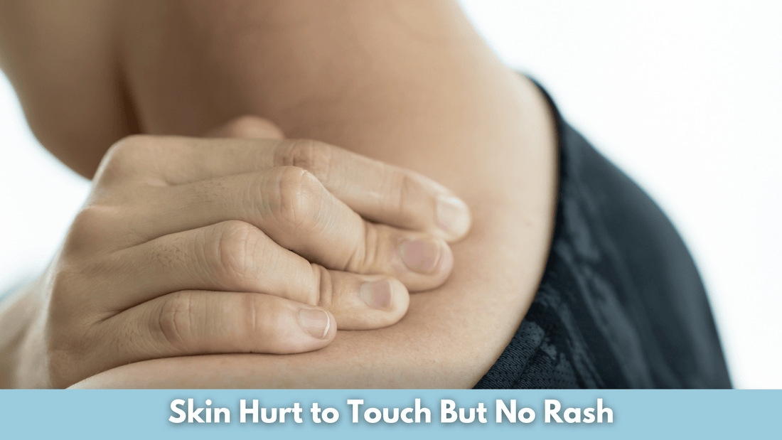 Skin Hurt to Touch But No Rash