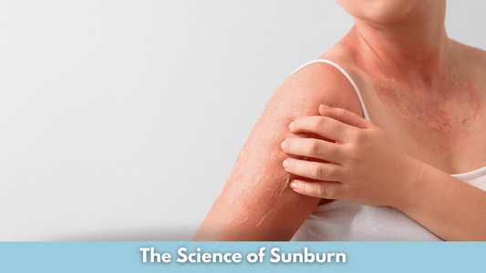 The Science of Sunburn