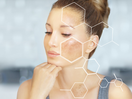 woman with dark spots on skin