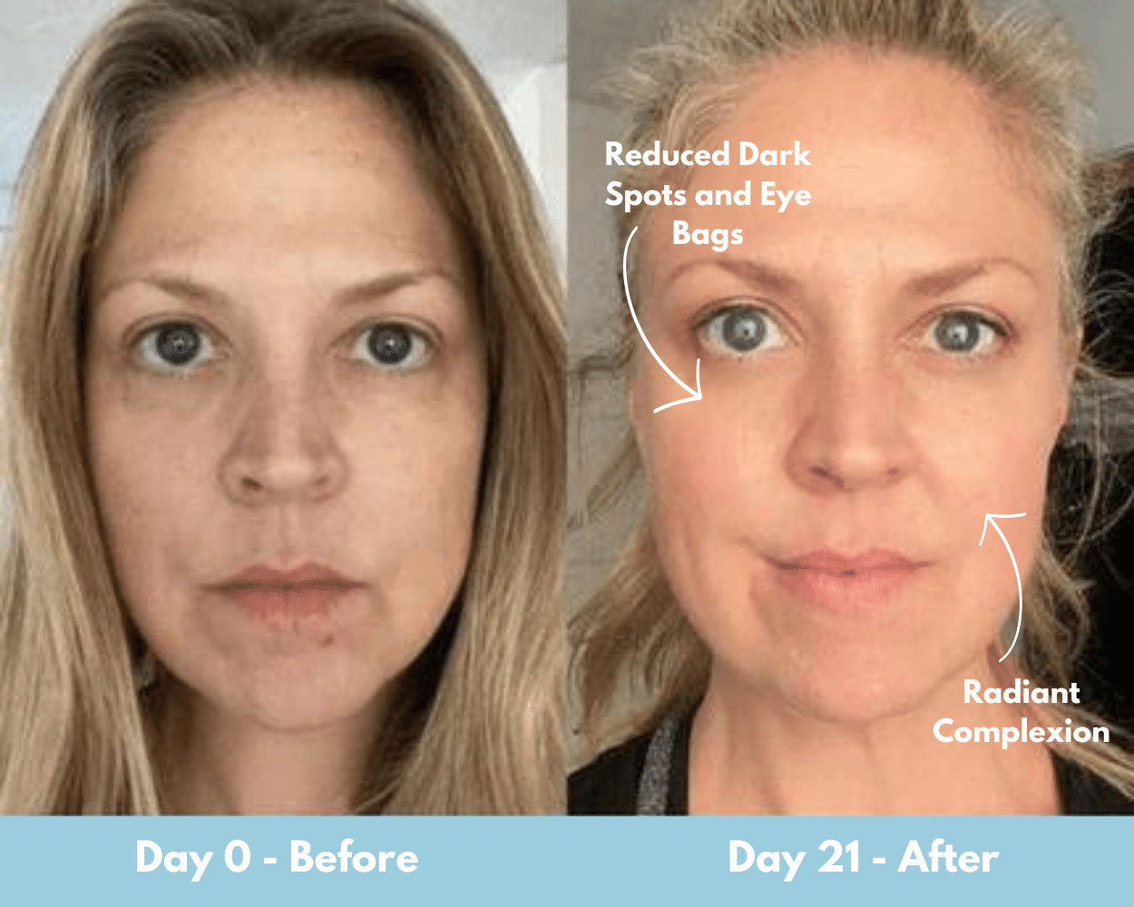 Micro Roller Face Glowing Benefits