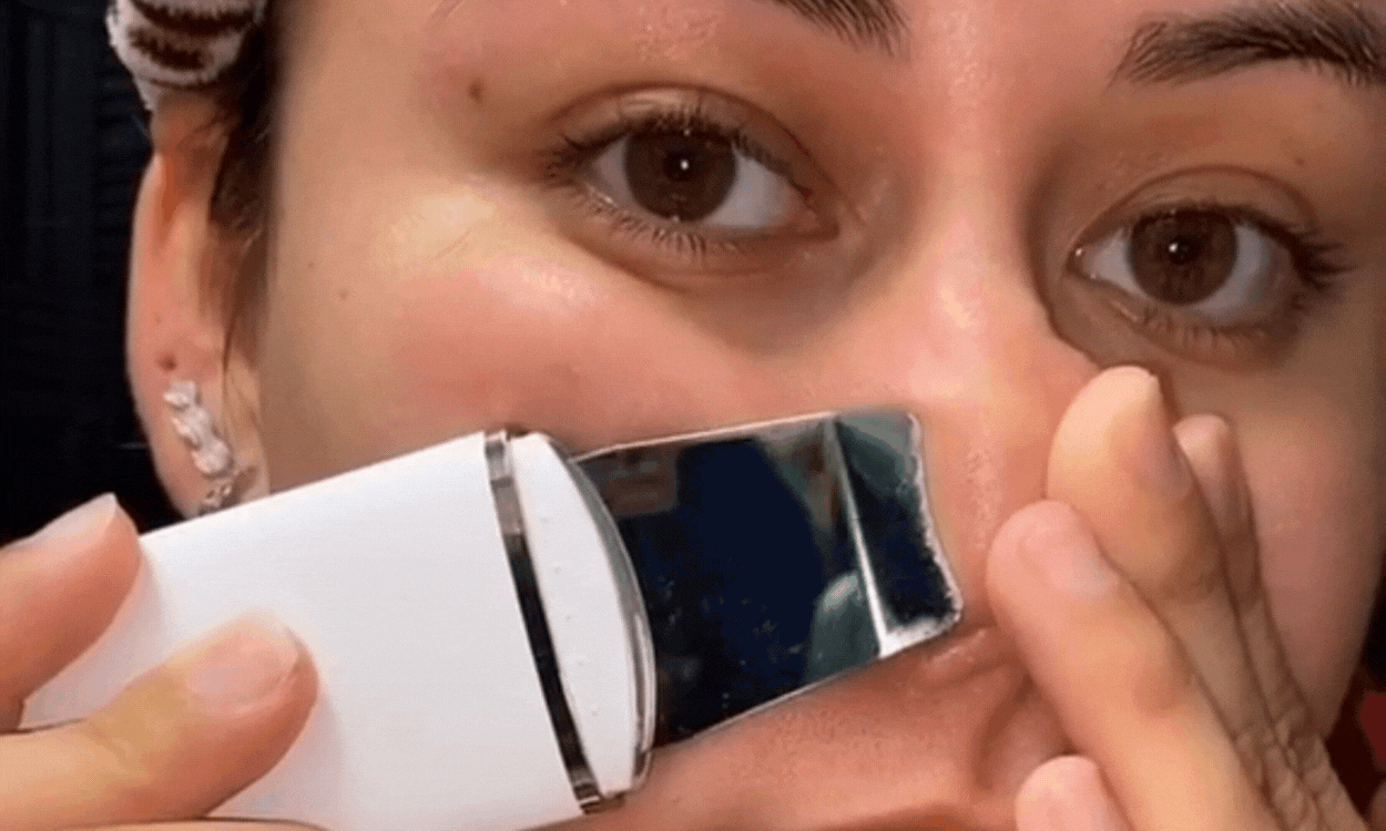 Ultrasonic Skin Scraper Blackhead Remover