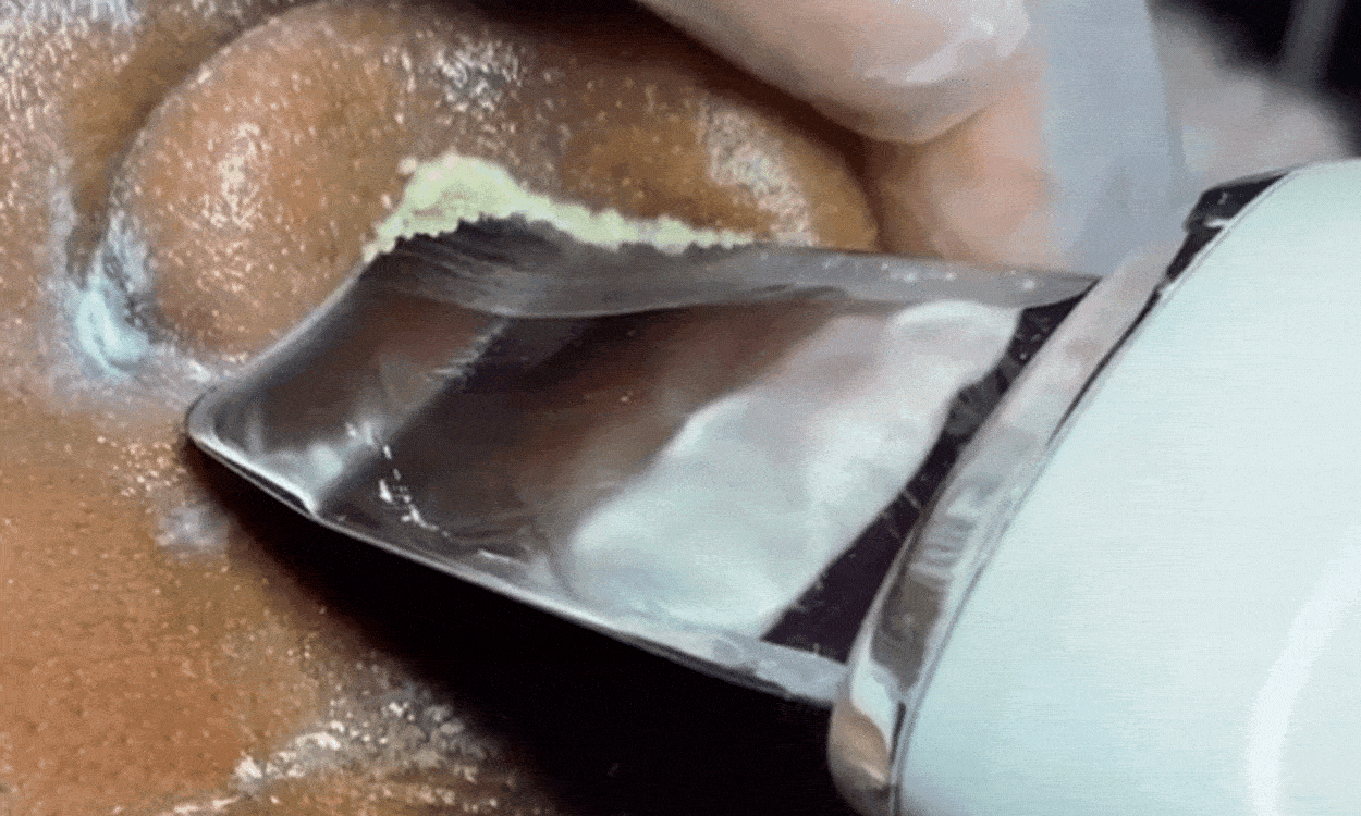 Ultrasonic Face Scraper Blackhead Remover